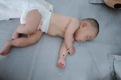 广州代怀试管生子孕妇前庭大腺囊肿